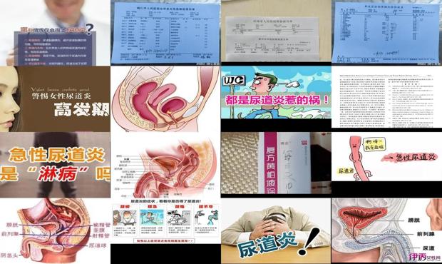 汕头急性尿道炎