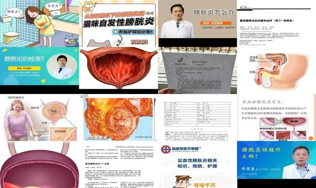 汕头膀胱炎