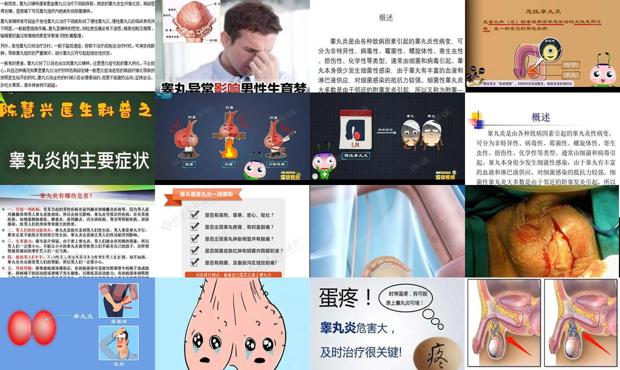 汕头睾丸炎有什么症状 是怎样引起的