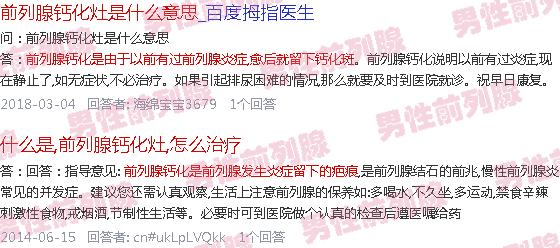 汕头前列腺钙化灶是什么意思,怎么治疗