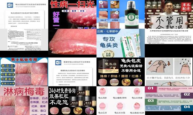 汕头龟头炎怎么治疗**