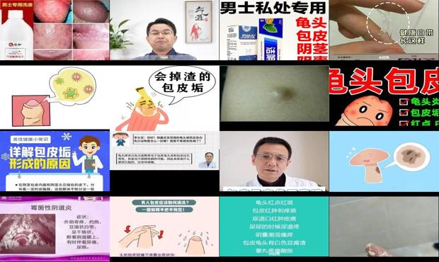 汕头龟头炎有白色豆腐渣
