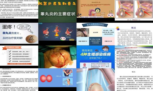 汕头睾丸炎的症状