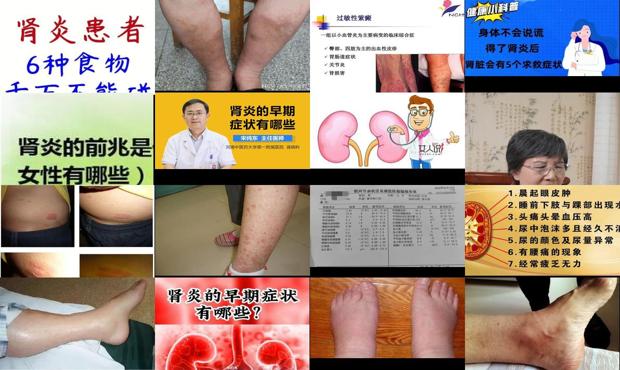 汕头肾炎的早期症状