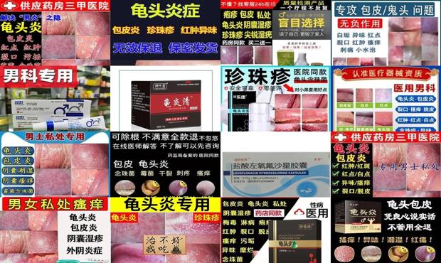 汕头霉菌性龟头炎用什么药