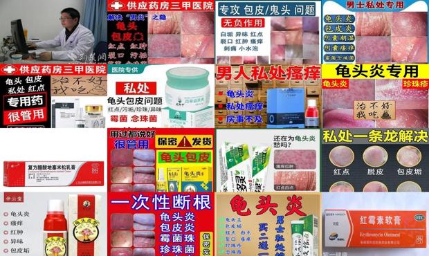 汕头龟头炎怎么治疗用什么药膏
