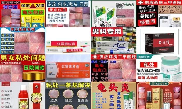 汕头龟头炎要擦什么药膏