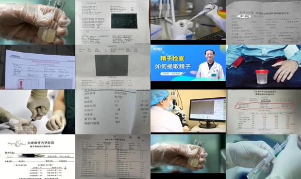 汕头医院检查精子质量是怎么提取精子的