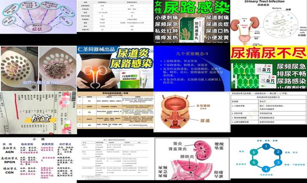 汕头膀胱炎和尿路感染的区别