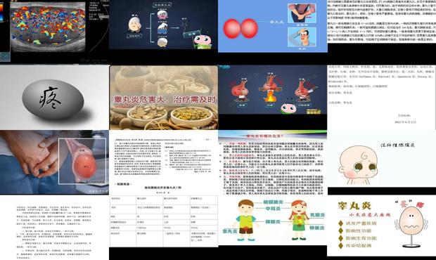 汕头急性睾丸炎