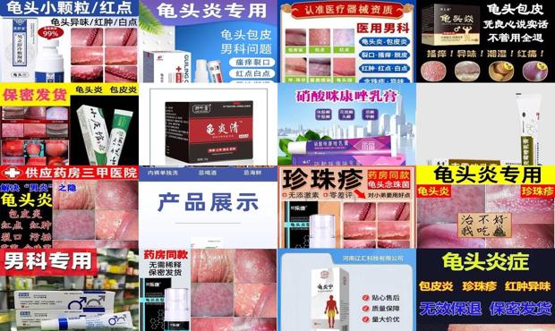 汕头真菌性龟头炎用什么药