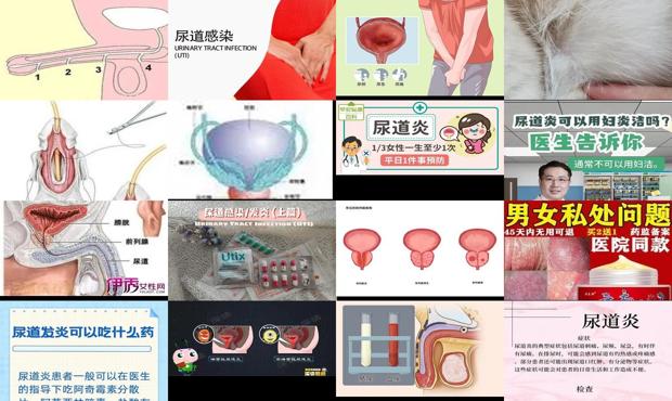 汕头尿道发炎怎么办