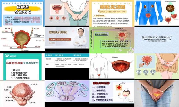 汕头膀胱炎是什么引起的