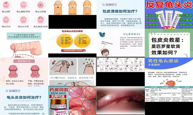 汕头包皮炎怎么治疗