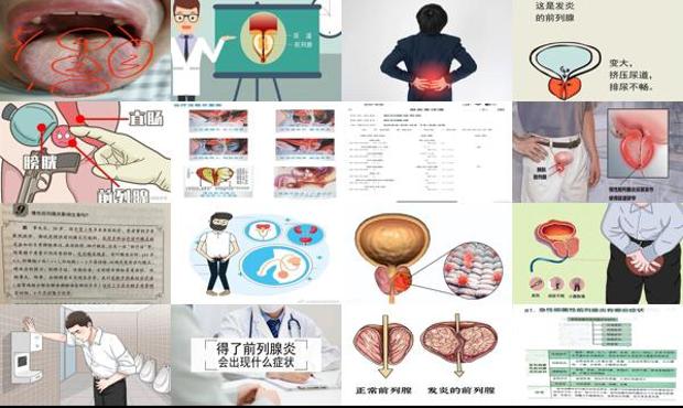 汕头前列腺炎*明显的症状