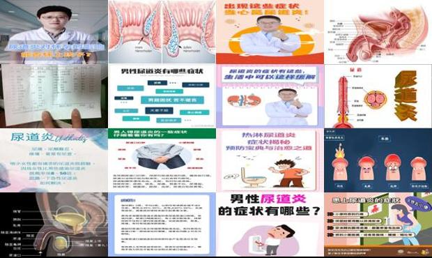 汕头尿道炎症状表现男