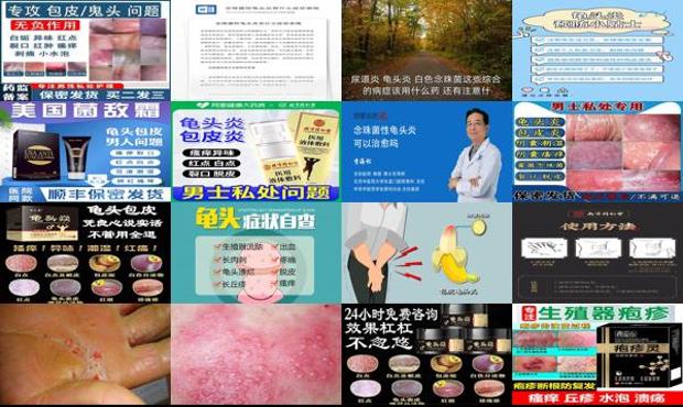 汕头念珠球菌龟头炎