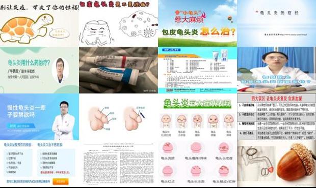 汕头如何治愈龟头炎