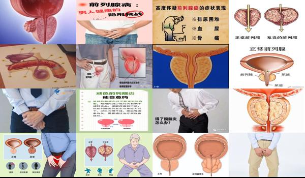 45岁男性前列腺有什么症状 - 汕头45岁男人前列腺的症状